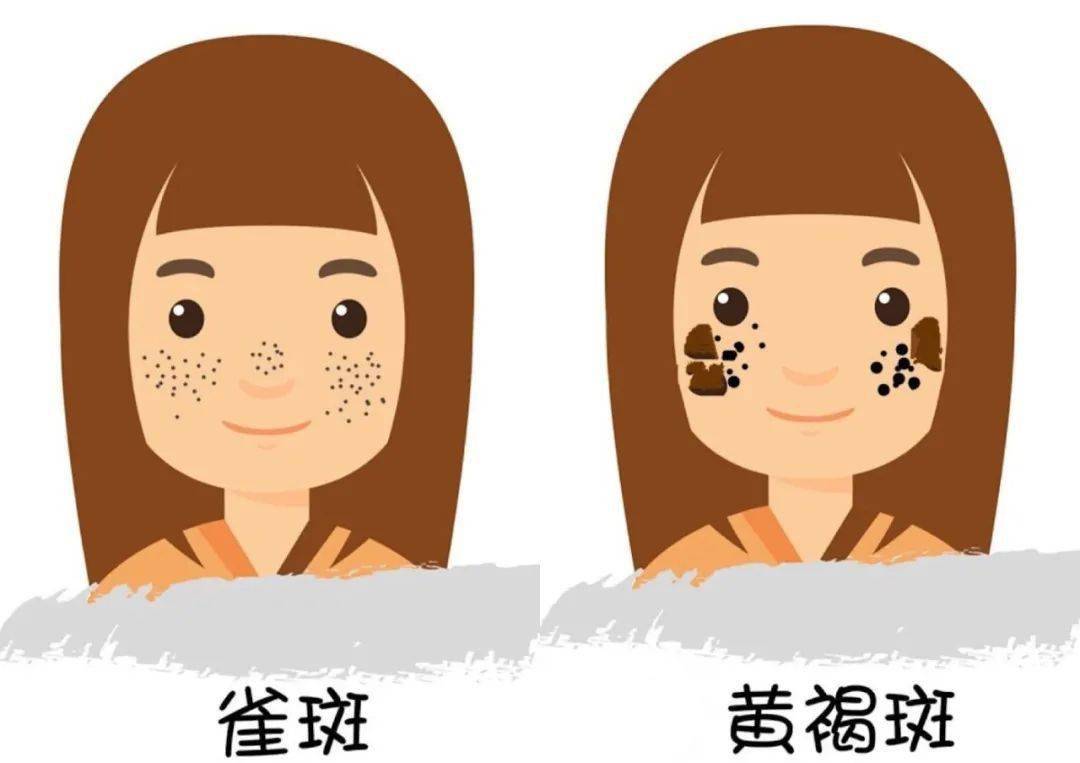 褐黄病是什么原因引起的,褐青色斑产生的原因