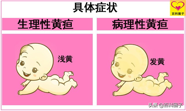 6张图告诉你,黄疸防治与黄疸正常值参考