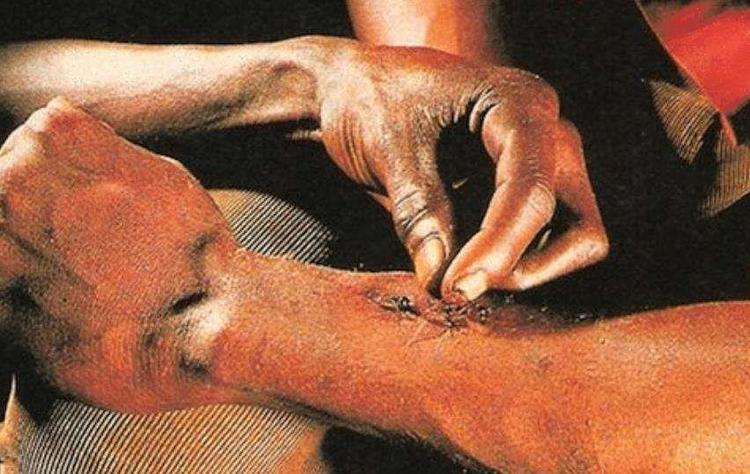 非洲流传已久的神奇巫术，治疗伤口只需蚂蚁缝合，专家：不可思议