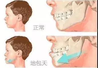 宝宝长乳牙关注事项及禁忌,一定要关注孩子的乳牙很重要
