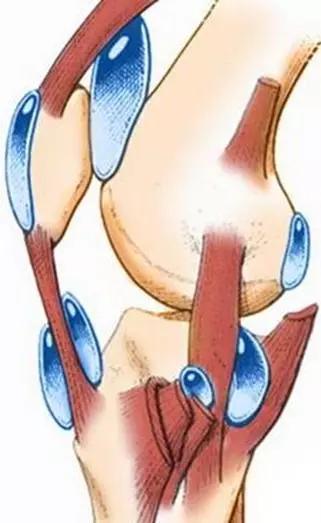 靠康复锻炼减少创伤性关节炎,怎么预防膝关节退化