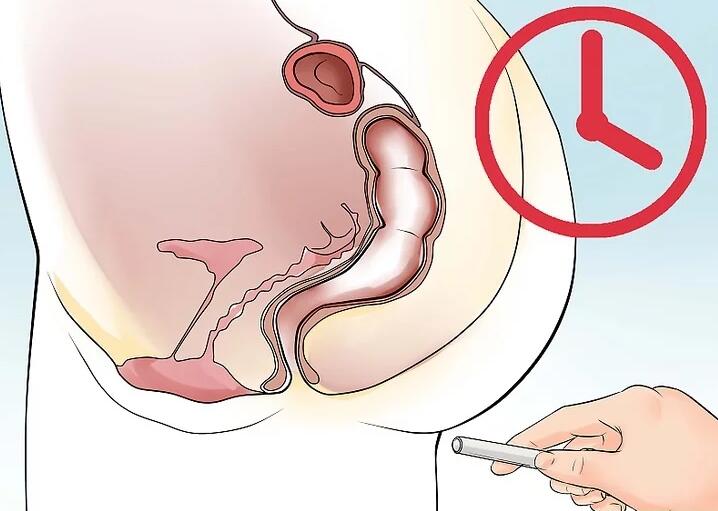 得了痔疮怎么办学会三招治痔疮,得了痔疮别担心这个小方法快试试