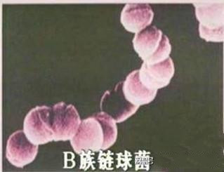 今天发现尿是红色的是怎么回事,这几天尿有点红是怎么回事啊