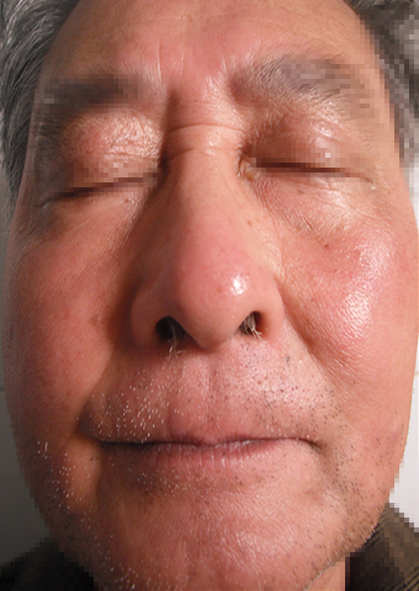 紫外线消毒产品可靠吗,紫外线消毒靠谱吗