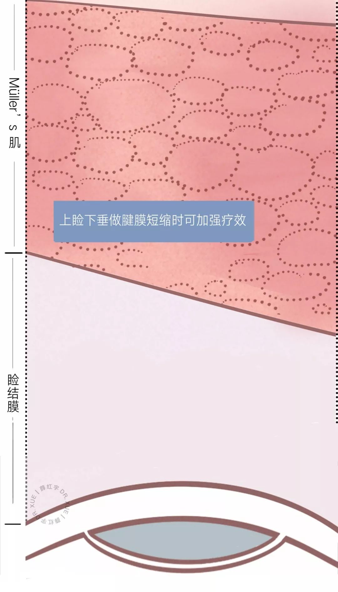 眼睛种类图解漫画,漫画眼睛的几种形态