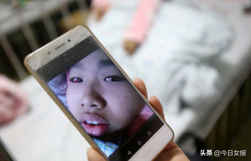 夫妻赚钱救自己的患白血病孩子,卖房救白血病妻子