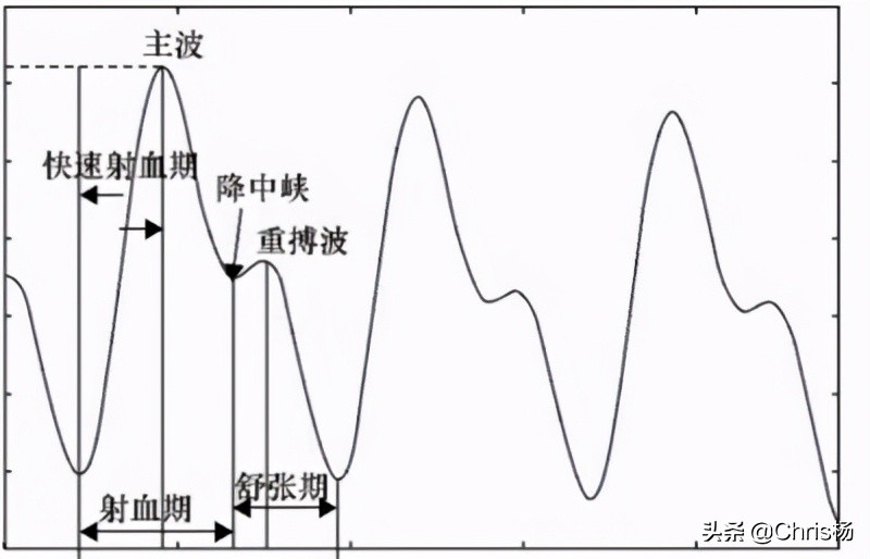 测血压血糖最准确的手表,能测血压的手表你用过吗