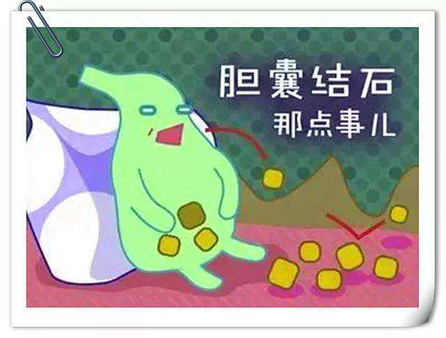 胆囊切除术后关注事项和饮食禁忌,微创胆囊切除手术出院后关注事项