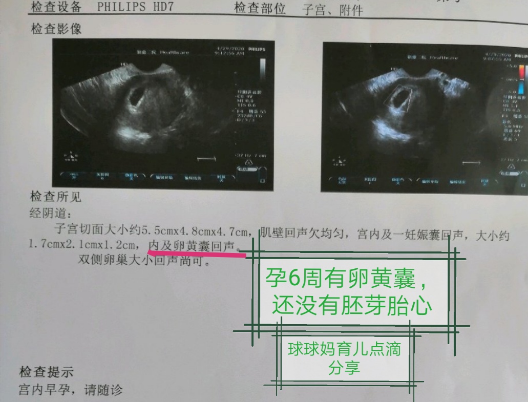最简单的孕期报告单整理,孕期产检报告单怎么整理
