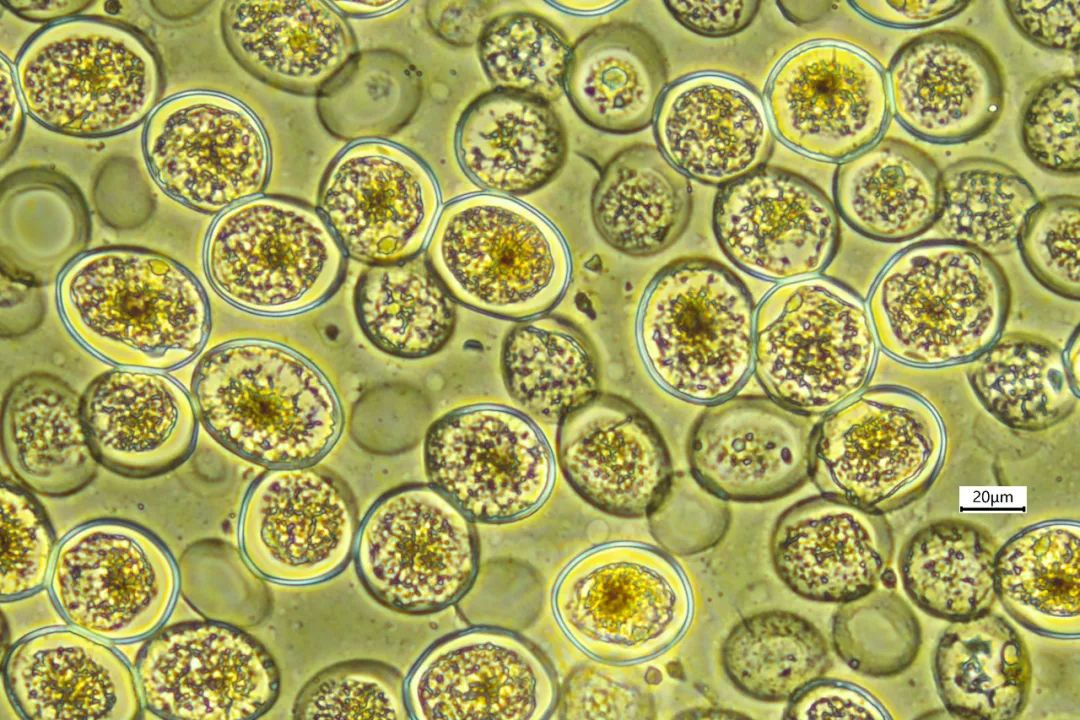 宠物寄生虫会传染人吗有什么症状,养宠物容易得寄生虫吗