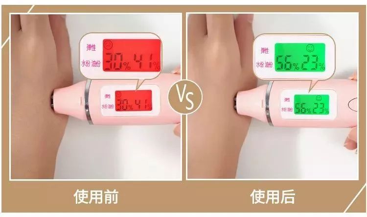 秋冬手干裂擦手霜,冬天手脚干裂涂什么护肤品