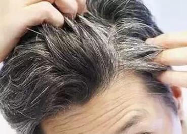 白发转黑视频成功案例,原始点白发转黑发案例