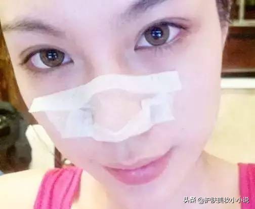 脸蛋油腻、毛孔粗大、鼻子起皮是怎么引起的呢？日常护肤小常识