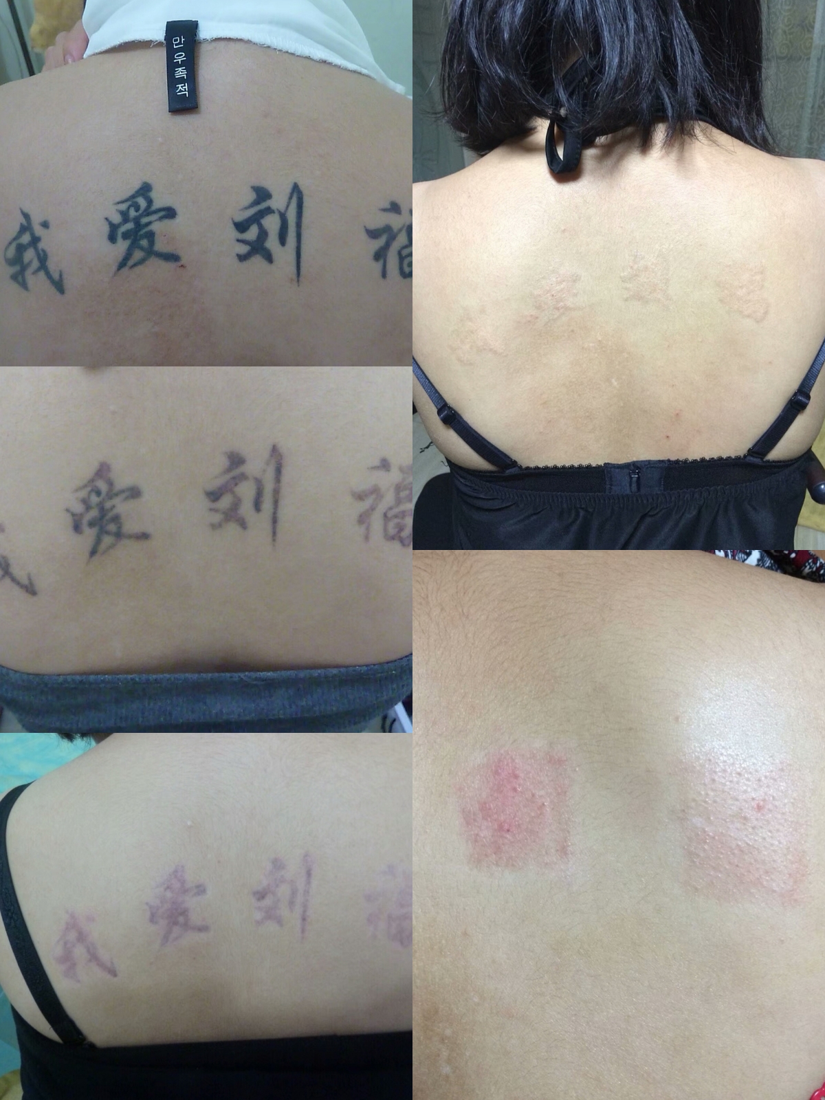 洗纹身咨询李医生,昆明李医生洗纹身是真的吗