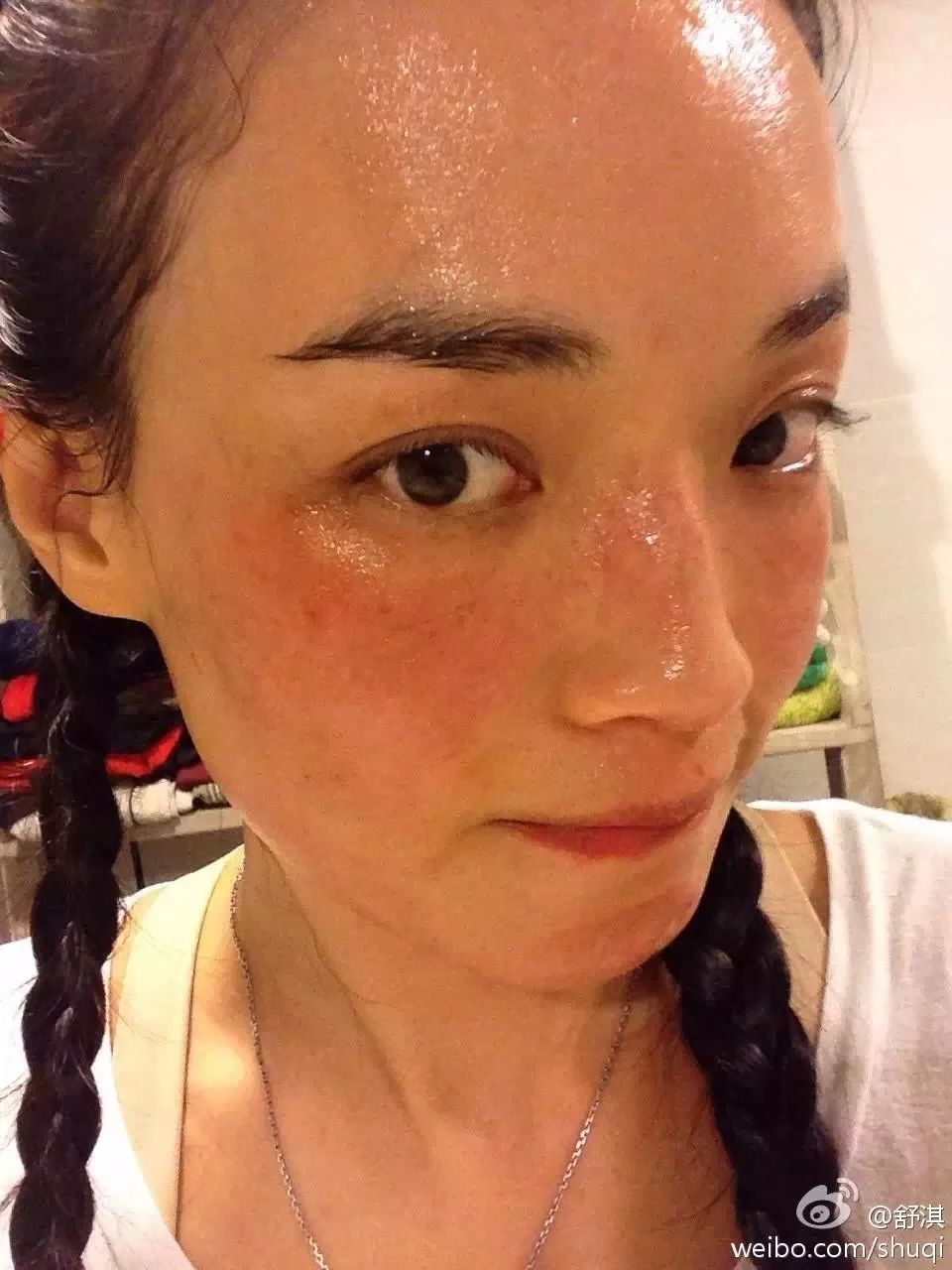 换季护肤攻略拯救恼人敏感肌,换季肌肤敏感处理三天就好啦