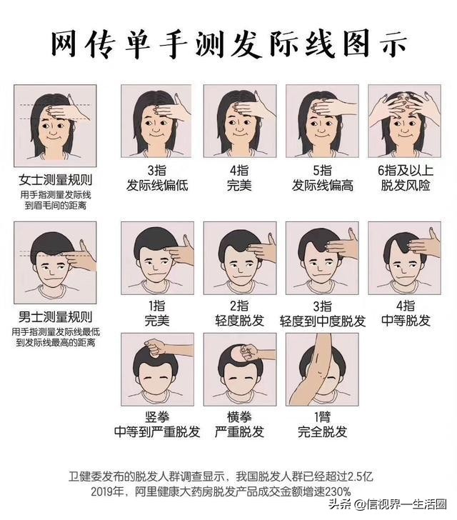 发际线太高了怎么调整,额头发际线过低怎么处理