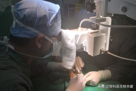 骨折手术后需要关注，什么情况下容易出现钢板断裂？