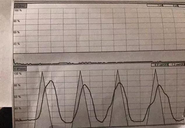 elle风尚大典刘诗诗,ella产后后遗症