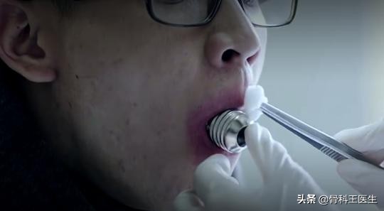 为什么有人会往直肠塞异物,为什么很多人都向直肠里塞异物