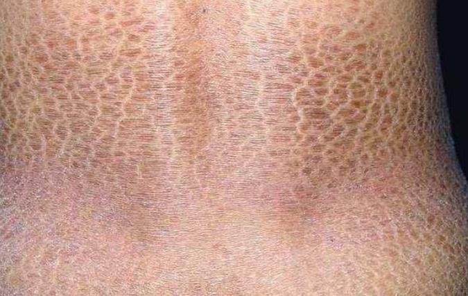 常见皮肤病科普,皮肤病症状科普大全