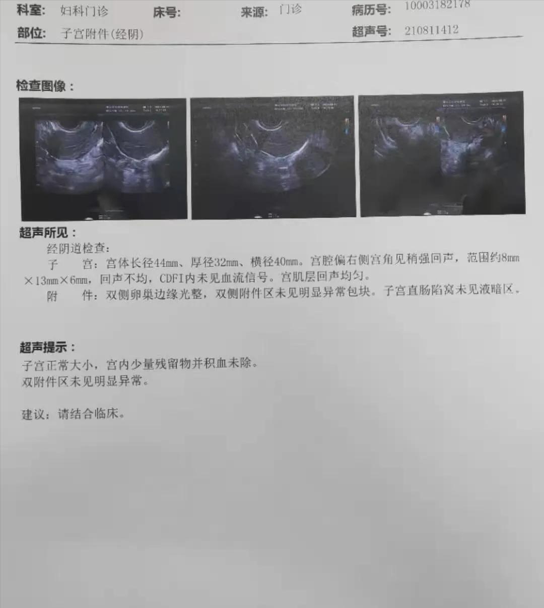 中医把脉入门必背口诀看怀孕,中医号脉怎么判断流产