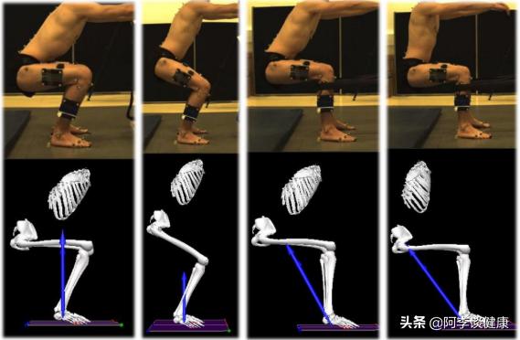 膝盖前侧疼痛一招解决,缓解膝盖侧方疼的10个小妙招