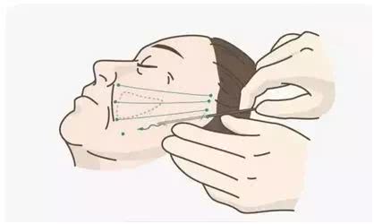 号称“1小时逆龄10年”的微整？我亲身体验了