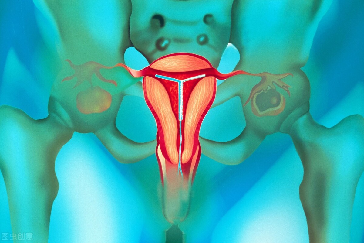 女性来月经怎么办,女生突然来月经了怎么解决