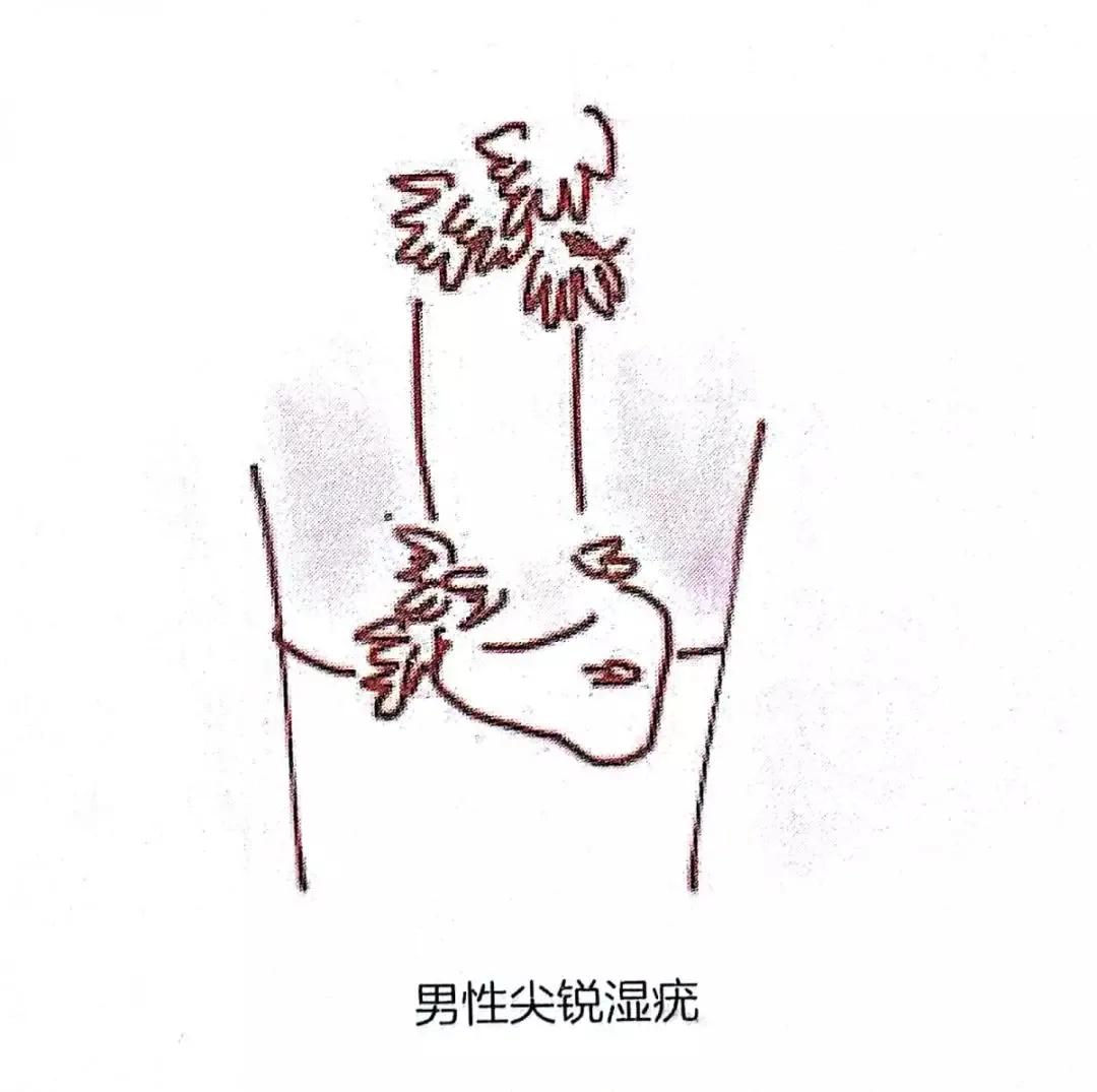 光动力治疗三个必要条件,光动力治疗标准操作过程