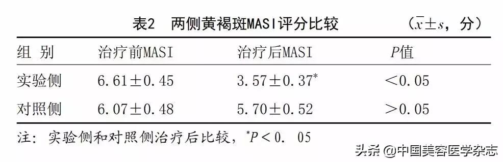 磺胺甲环酸褐斑去除最有效的办法,氨甲环酸祛黑色素多久能见效