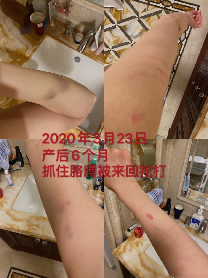 张培萌妻子讲述家暴细节值得推敲,张培萌被控诉家暴