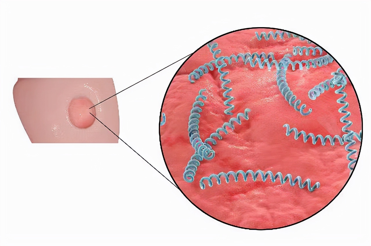 聊天记录爆出真实的人间，老公说工作太累了长湿疹，其实是梅毒