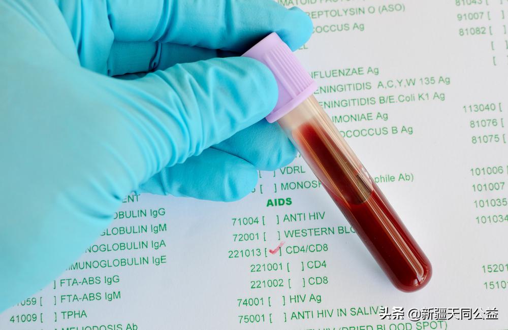 为什么hiv病人cd4比值偏低,低危感染艾滋病的几率大吗